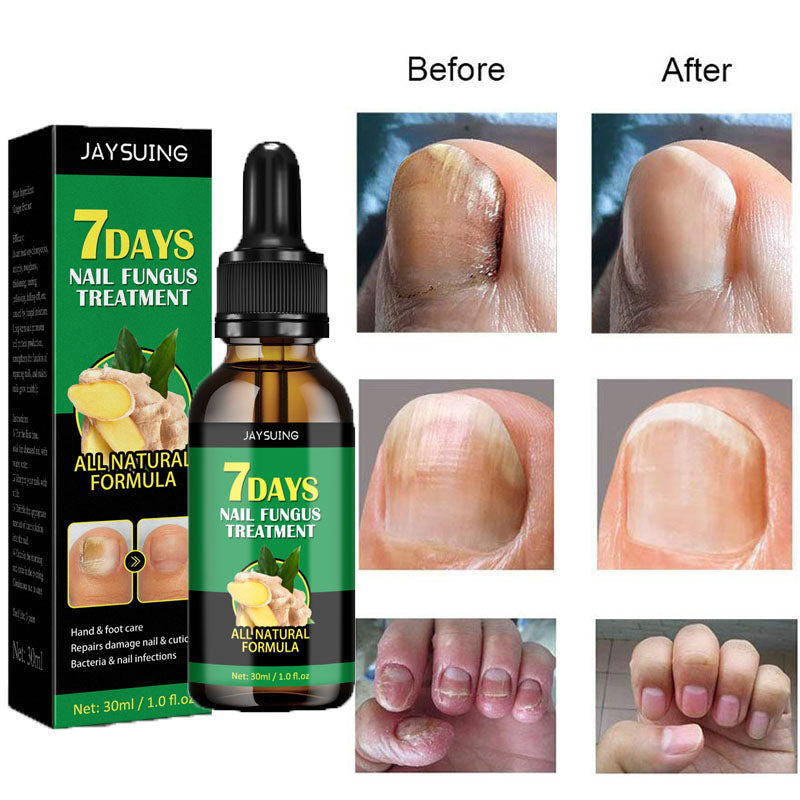 Antifungal Nail Serum.