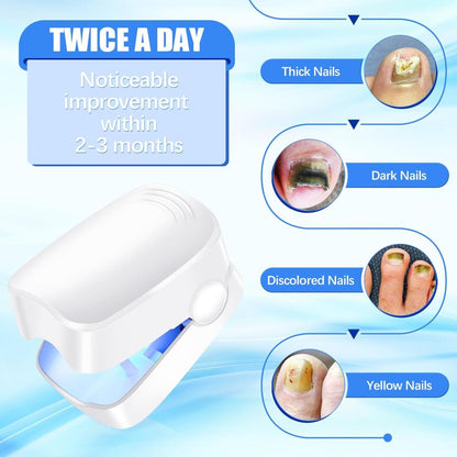 Laser Device for Nail Fungus Treatment